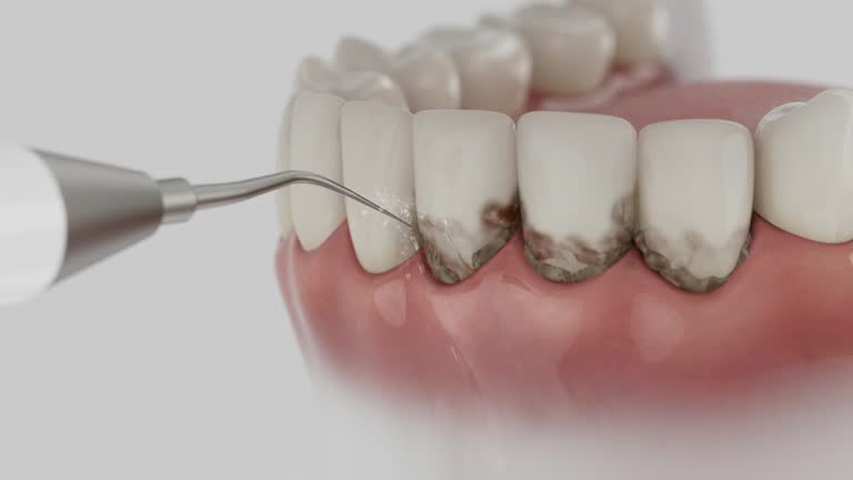 Reliable Teeth Cleaning And Checkup contractor in Iberia Parish County, LA by Dentist Open Now